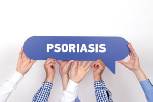 Psoriasis-treatments-kelowna