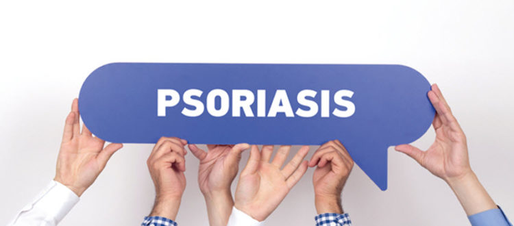 Psoriasis-treatments-kelowna